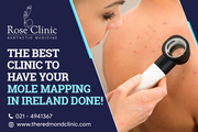 The best clinic to have your mole mapping in Ireland done!