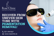 Recover from uneven skin tone with pigmentation removal!