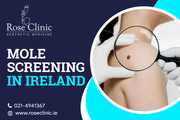 Beware of the ABCDEs of moles! Book mole screening in Ireland!