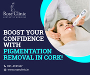 Boost your confidence with pigmentation removal in Cork!