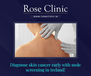 Diagnose skin cancer early with mole screening in Ireland!