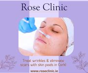 Treat wrinkles & eliminate scars with skin peels in Cork!