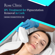 The Rose Clinic Brings Advanced IPL Treatment for Pigmentation Removal