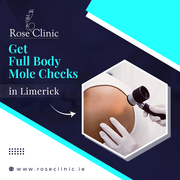 Get Full Body Mole Checks in Limerick - Full Body Dermoscopy